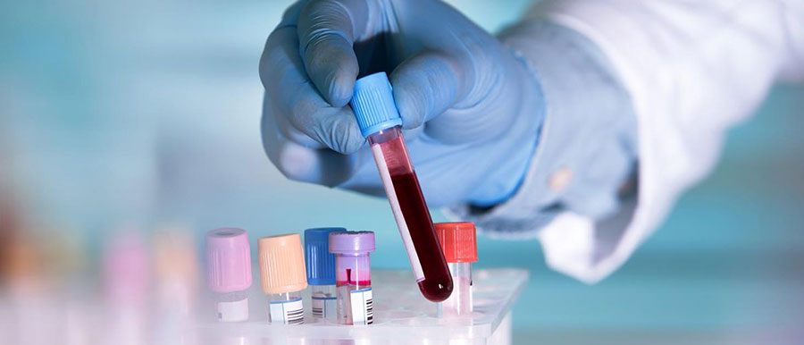 آزمایش خون برای تشخیص مصرف متادون
